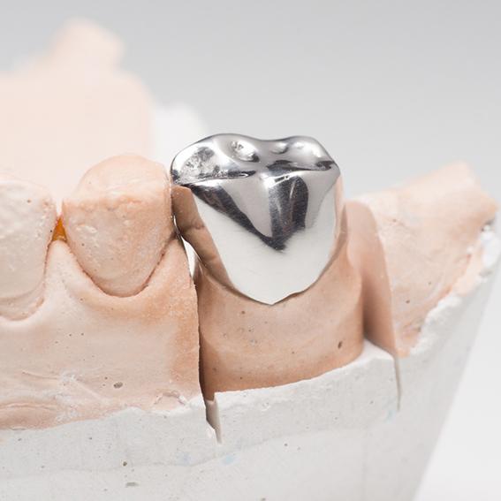 A stainless-steel dental crown